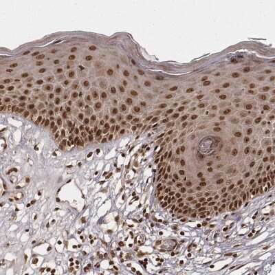 Immunohistochemistry-Paraffin: NFX1 Antibody [NBP2-57963]