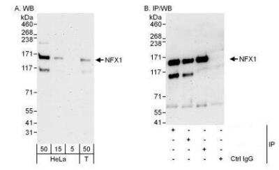 Western Blot: NFX1 Antibody [NBP1-49931]