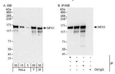 Western Blot: NFX1 Antibody [NBP1-49933]