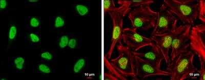 Immunocytochemistry/ Immunofluorescence: NFYA Antibody [NBP2-19533]