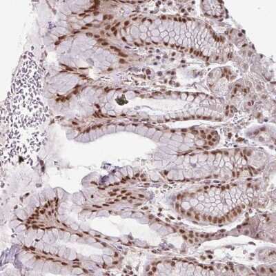 Immunohistochemistry-Paraffin: NFYA Antibody [NBP2-48977]