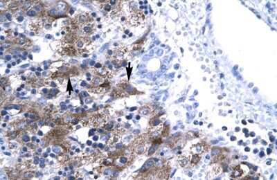 Immunohistochemistry: NFYA Antibody [NBP2-87907]