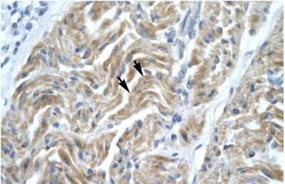 Immunohistochemistry: NFYA Antibody [NBP2-87908]