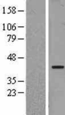 Western Blot: NFYA Overexpression Lysate [NBL1-13627]