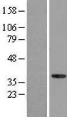 Western Blot: NFYA Overexpression Lysate [NBL1-13628]