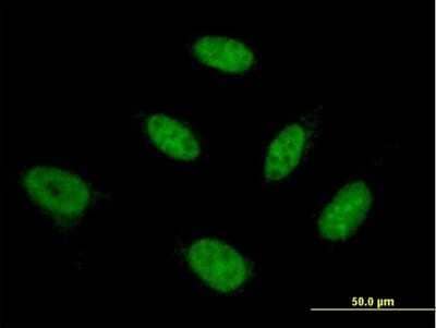 Immunocytochemistry/ Immunofluorescence: NFYB Antibody (5D1) [H00004801-M03]