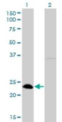 Western Blot: NFYB Antibody (6H6) [H00004801-M01]