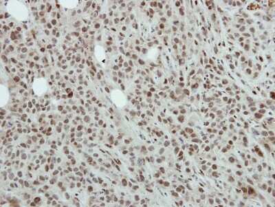 Immunohistochemistry-Paraffin: NFYB Antibody [NBP2-19534]