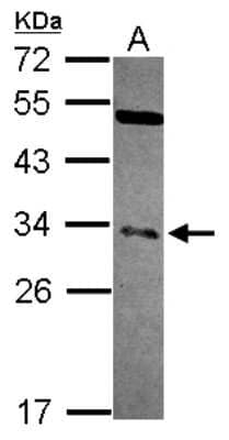 Western Blot: NFYB Antibody [NBP2-19534]