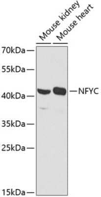 Western Blot: NFYC AntibodyBSA Free [NBP2-93399]