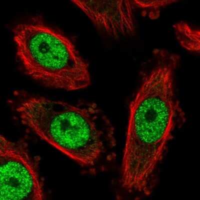 Immunocytochemistry/ Immunofluorescence: NFYC Antibody [NBP2-55002]