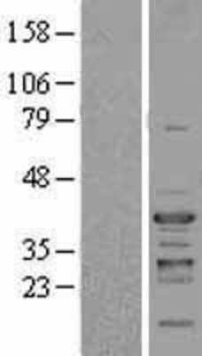 Western Blot: NFYC Overexpression Lysate [NBL1-13630]