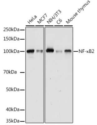 Western Blot: NFkB p100/p52 AntibodyAzide and BSA Free [NBP2-94268]