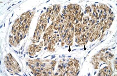 Immunohistochemistry: NFkB p100/p52 Antibody [NBP2-87905]