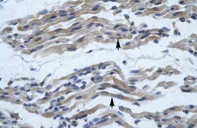 Immunohistochemistry: NFkB p100/p52 Antibody [NBP2-87905]