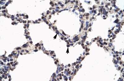 Immunohistochemistry: NFkB p100/p52 Antibody [NBP2-87906]