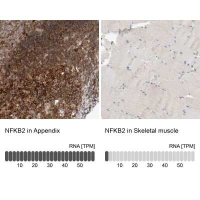 Immunohistochemistry-Paraffin: NFkB p100/p52 Antibody [NBP1-87759]