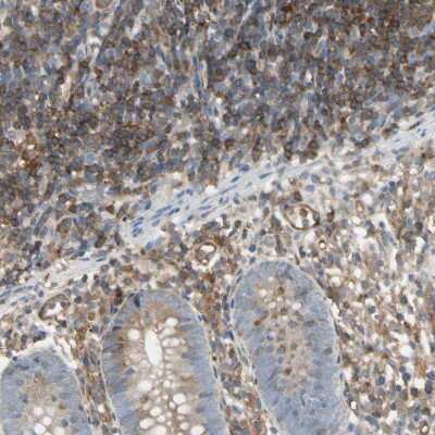 Immunohistochemistry-Paraffin: NFkB2/NFkB p100 Antibody [NBP1-87760]