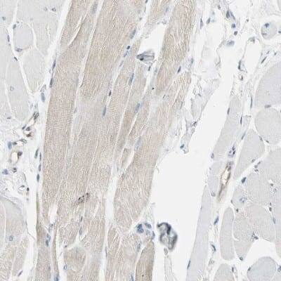 Immunohistochemistry-Paraffin: NFkB2/NFkB p100 Antibody [NBP1-87760]