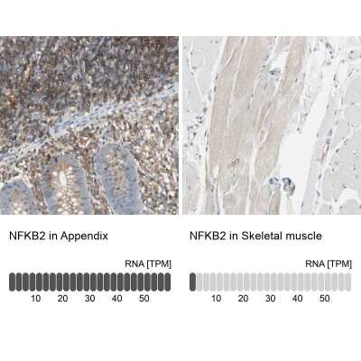 Immunohistochemistry-Paraffin: NFkB2/NFkB p100 Antibody [NBP1-87760]