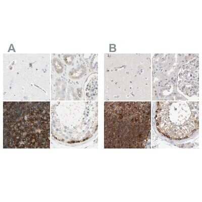 Immunohistochemistry-Paraffin: NFkB2/NFkB p100 Antibody [NBP1-87760]