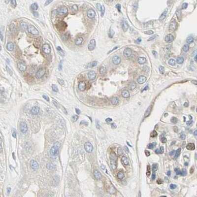 Immunohistochemistry-Paraffin: NFkB2/NFkB p100 Antibody [NBP1-87760]