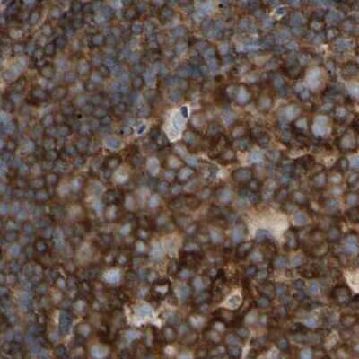 Immunohistochemistry-Paraffin: NFkB2/NFkB p100 Antibody [NBP1-87760]