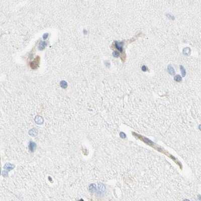 Immunohistochemistry-Paraffin: NFkB2/NFkB p100 Antibody [NBP1-87760]