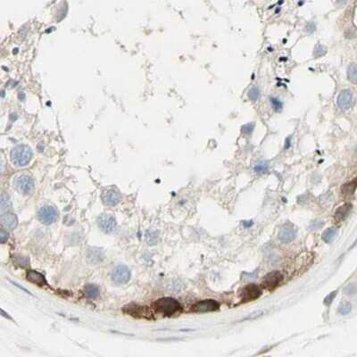 Immunohistochemistry-Paraffin: NFkB2/NFkB p100 Antibody [NBP1-87760]