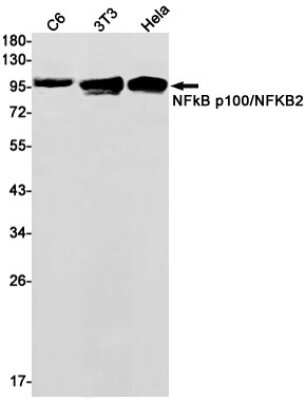 Western Blot: NFkB p100/p52 Antibody (S04-4D6) [NBP3-14959]