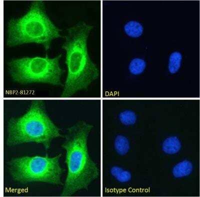 Immunocytochemistry/ Immunofluorescence: NFkB p100/p52 Antibody (SAIC-26C-15) - Azide and BSA Free [NBP2-81272]