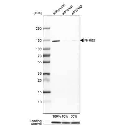 Western Blot: NFkB2/NFkB p100 Antibody [NBP1-87760]