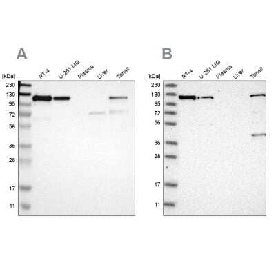 Western Blot: NFkB2/NFkB p100 Antibody [NBP1-87760]