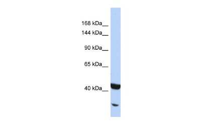 Western Blot: NFkB p100/p52 Antibody [NBP2-87904]