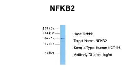 Western Blot: NFkB p100/p52 Antibody [NBP2-87905]