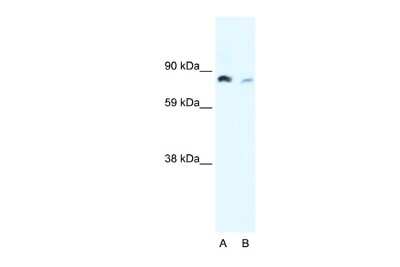 Western Blot: NFkB p100/p52 Antibody [NBP2-87906]