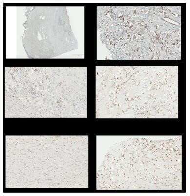 Immunohistochemistry: NFkB p105/p50 Antibody (2J10D7) - Azide and BSA Free [NBP2-80872]