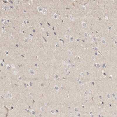 Immunohistochemistry-Paraffin: NFkB p105/p50 Antibody [NBP1-87758]