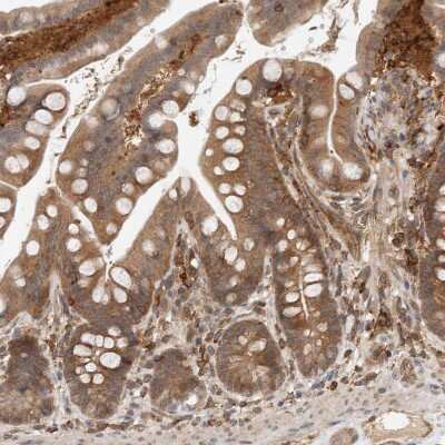 Immunohistochemistry-Paraffin: NFkB p105/p50 Antibody [NBP1-87758]