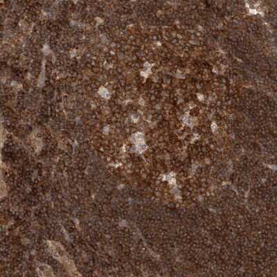 Immunohistochemistry-Paraffin: NFkB p105/p50 Antibody [NBP1-87758]