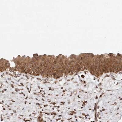 Immunohistochemistry-Paraffin: NFkB p105/p50 Antibody [NBP1-87758]