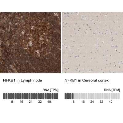 Immunohistochemistry-Paraffin: NFkB p105/p50 Antibody [NBP1-87758]