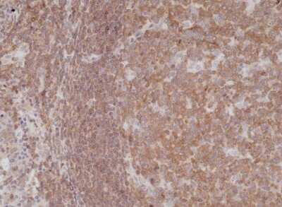 Immunohistochemistry-Paraffin: NFkB p105/p50 Antibody (RM299) [NBP2-61568]