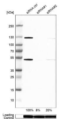 Western Blot: NFkB p105/p50 Antibody [NBP1-87758]