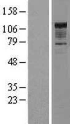 Western Blot: NFkB p105/p50 Overexpression Lysate [NBL1-13619]