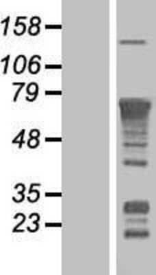 Western Blot: RelA/NFkB p65 Overexpression Lysate [NBL1-15276]