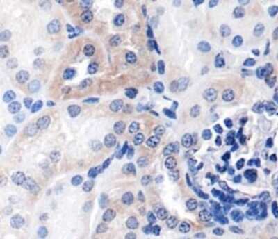 Immunohistochemistry: NFkB1/NFkB p105 Antibody - BSA Free [NBP1-77395]