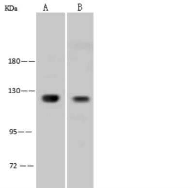 Western Blot: NFkB1/NFkB p105 Antibody [NBP3-05867]