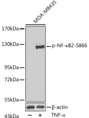 Western Blot: NFkB2/NFkB p100 [p Ser866] AntibodyAzide and BSA Free [NBP3-16894]