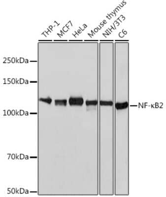 Western Blot: NFkB2/NFkB p100 Antibody (4K3V3) [NBP3-15809]